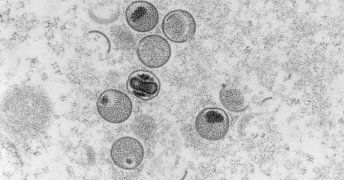 Veel mensen komen niet opdagen voor apenpokkenprik door vakantie | WNL