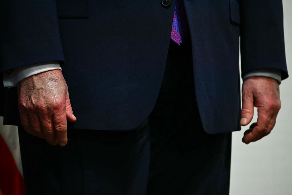 Trump maakt termijn mogelijk niet af door slechte gezondheid, zegt Amerikakenner: 'Fysiek is hij er écht anders aan toe'