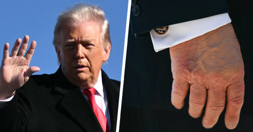 Hand van Donald Trump.